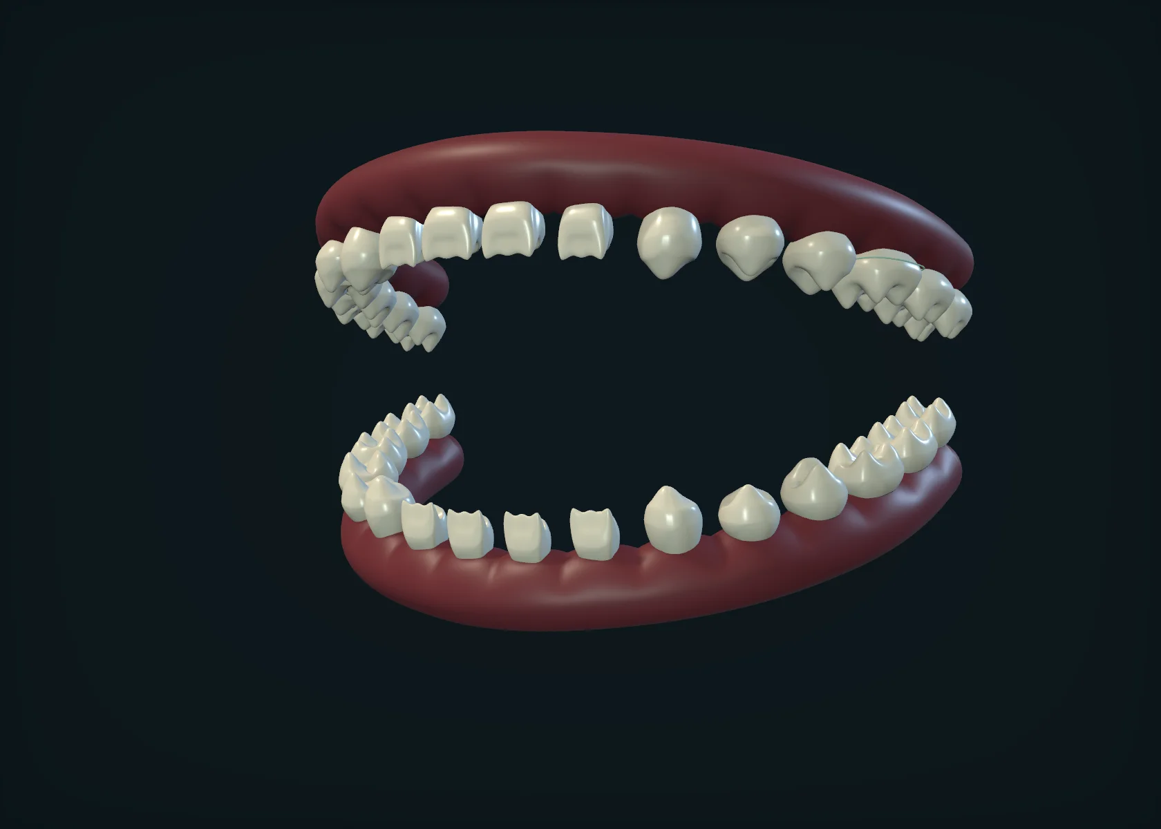 Схематическая 3D-модель, не скан пациента